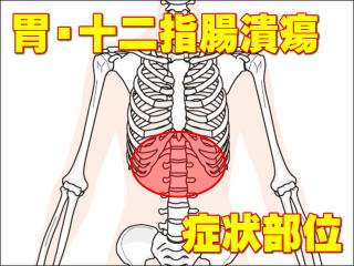 胃潰瘍・十二指腸潰瘍による症状部位・胸部