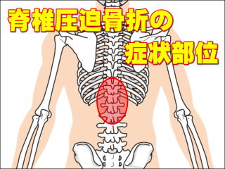 脊椎圧迫骨折の症状部位
