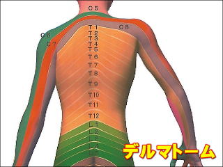 内臓体性反射のデルマトーム図