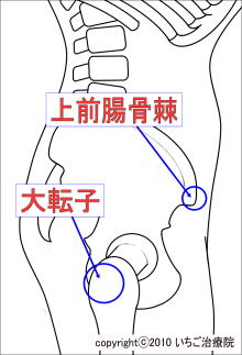 上前腸骨棘と大転子の図解
