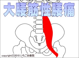 大腰筋解剖図