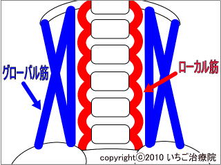 ローカル筋とグローバル筋の模式図