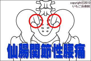仙腸関節の解剖図