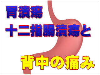 胃潰瘍・十二指腸潰瘍のイメージ画像