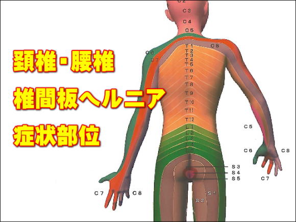 頚椎・腰椎椎間板ヘルニア症状部位のデルマトーム図