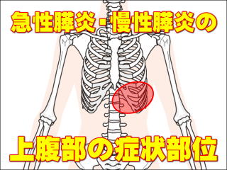 急性膵炎と慢性膵炎の上腹部の症状部位