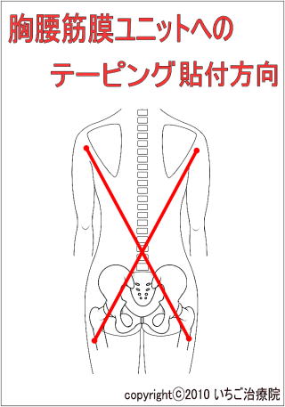 胸腰筋膜ユニットへのテーピング法