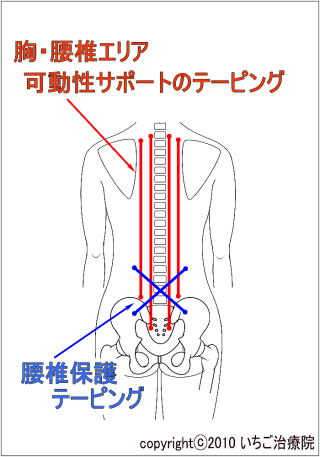 胸椎・腰椎エリアへのテーピング位置